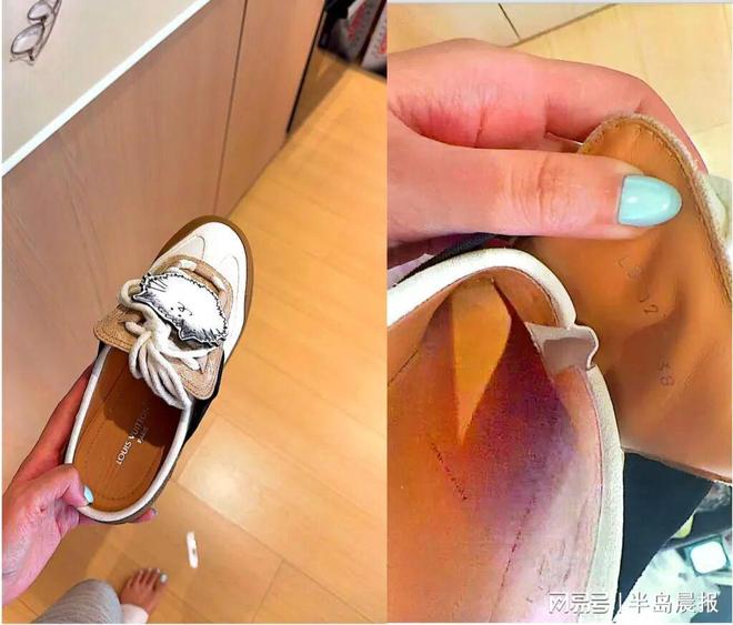 九游体育：女子购近万元LV运动鞋仅穿10分钟双脚破皮留疤！客服：不能退(图3)